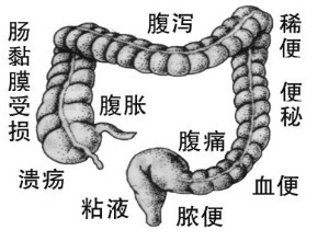 u=2959371518,816563946&fm=21&gp=0.jpg